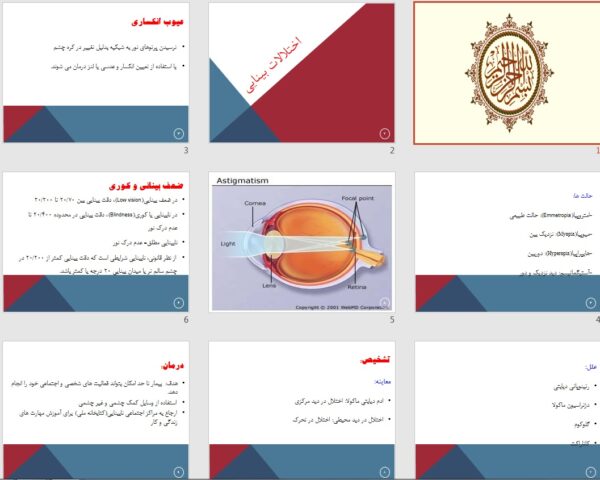 پاورپوینت پرستاری اختلالات بینایی - تصویر 2