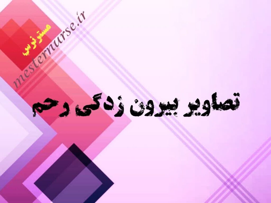 تصاویر بیرون زدگی رحم