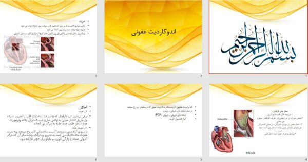 پاورپوینت پرستاری اندوکاردیت عفونی