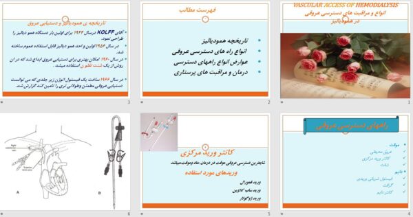 انواع دسترسی عروقی در همودیالیز - تصویر 2