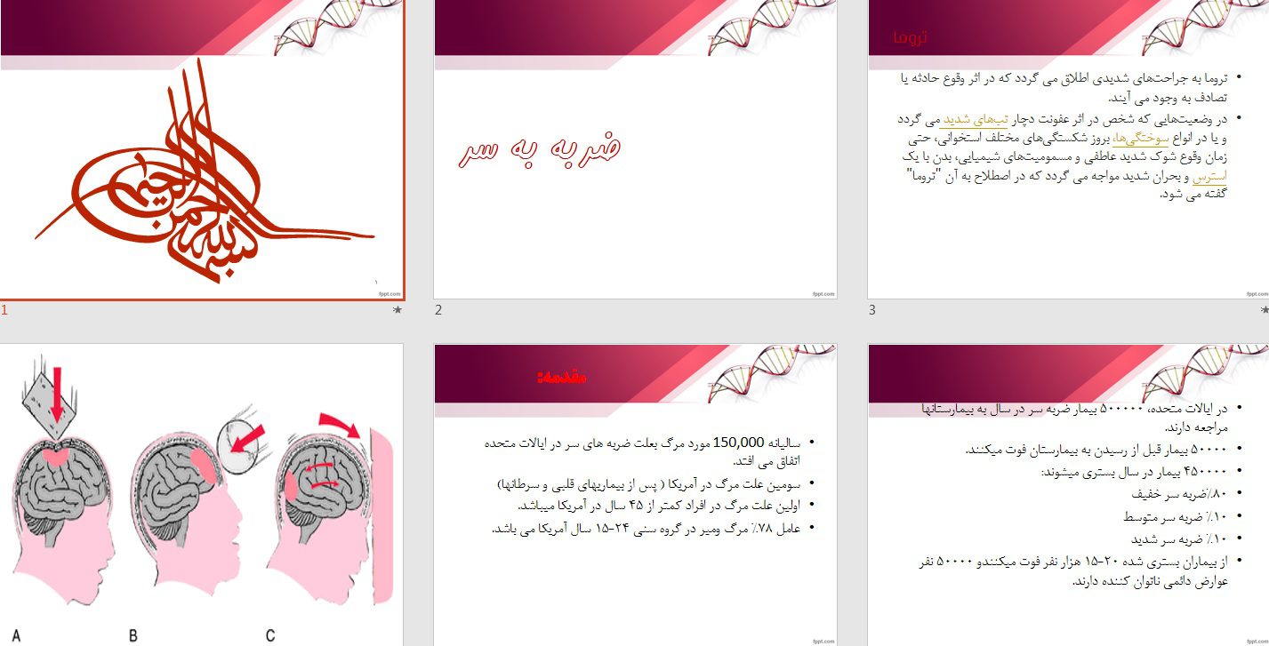 پاورپوینت پرستاری انواع هد تروما و ضربه به سر