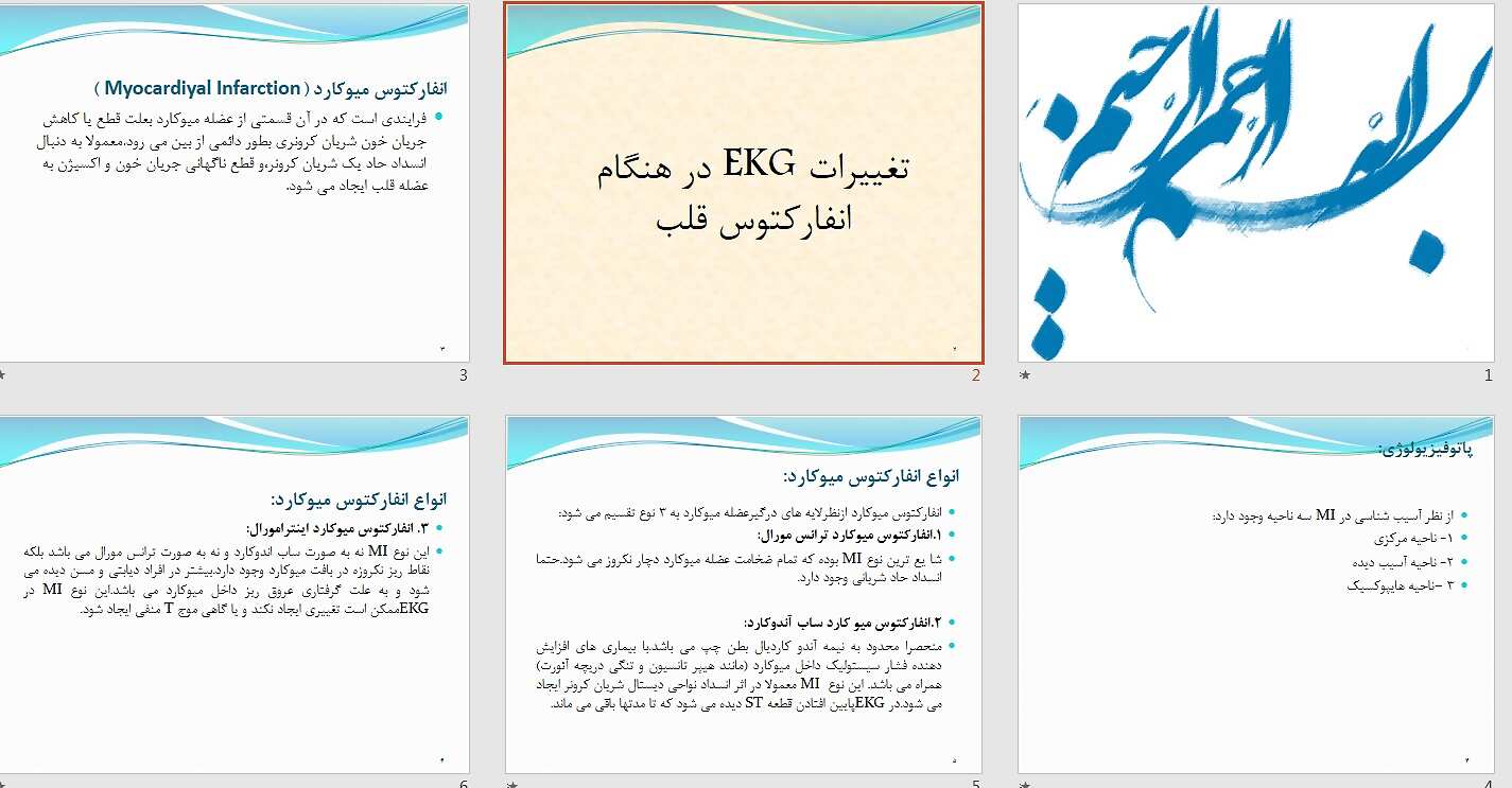 تغییرات نوار قلب در انفارکتوس میوکارد