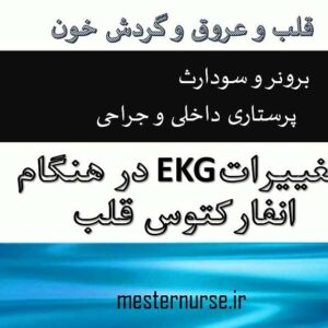 تغییرات نوار قلب در انفارکتوس میوکارد