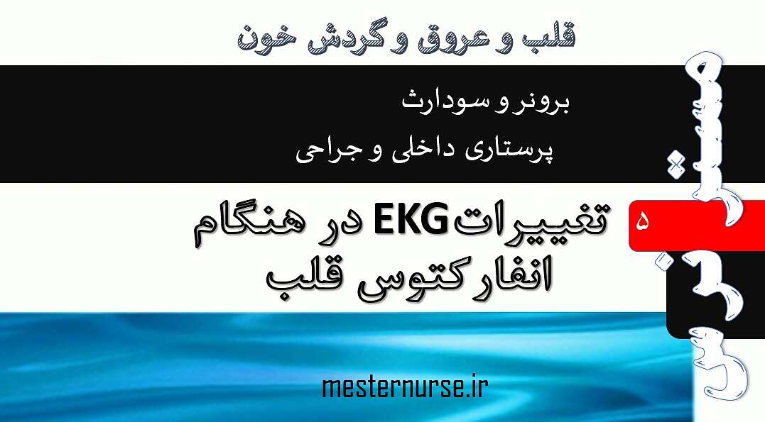 تغییرات نوار قلب در انفارکتوس میوکارد