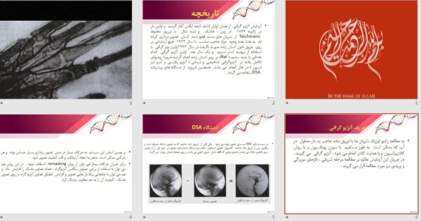 پاورپوینت آنژیوگرافی